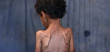 ONU alerta sobre risco de crise de fome para milhões de pessoas