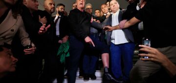 PF pericia tornozeleira de Bolsonaro para verificar se houve rompimento com material de soldagem