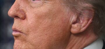 EUA eliminará advertências de tratamentos de reposição hormonal para a menopausa