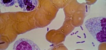 Cientistas resolvem mistério de 1,5 mil anos e identificam origem da 1ª pandemia do mundo