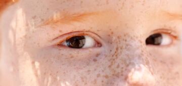 Reflexo branco nos olhos: entenda condição que assusta pais