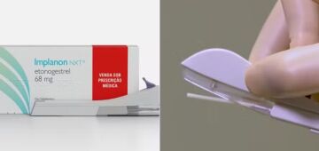 Implanon: Saúde recebe primeiras unidades de implante contraceptivo para o SUS; veja como funciona