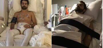 Cientistas brasileiros criam medicamento inédito que devolve mobilidade a pessoas tetraplégicas