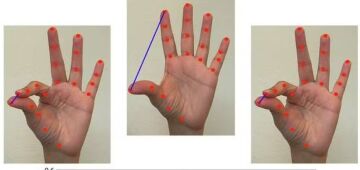Parkinson: IA detecta mudanças sutis de movimento em vídeos de toques de dedos