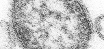 Canadá perde status de país livre do sarampo