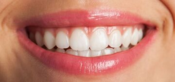 Dieta dos dentes: saiba o que comer para ter menos problemas de gengiva