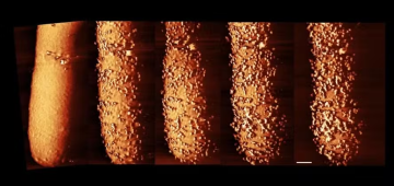 Uma a cada seis infecções bacterianas são resistentes a antibióticos, aponta relatório da OMS