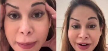 Maíra Cardi exibe rosto deformado após botox dar errado: "Olha que palhaçada"