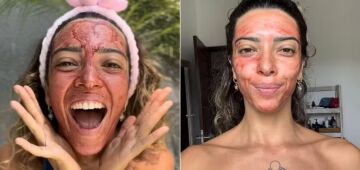 Máscara com sangue menstrual volta a viralizar nas redes: faz bem? O que diz a dermatologia