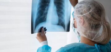 Pesquisadores brasileiros investigam forma inédita de tratar doenças pulmonares graves; entenda