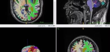 Mais músculos e menos gordura abdominal podem retardar o envelhecimento cerebral