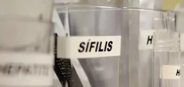 Sífilis continua em ritmo acelerado de crescimento no Brasil