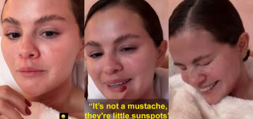 Selena Gomez ri ao responder pergunta sobre 'não depilar bigode' e explica que tem melasma