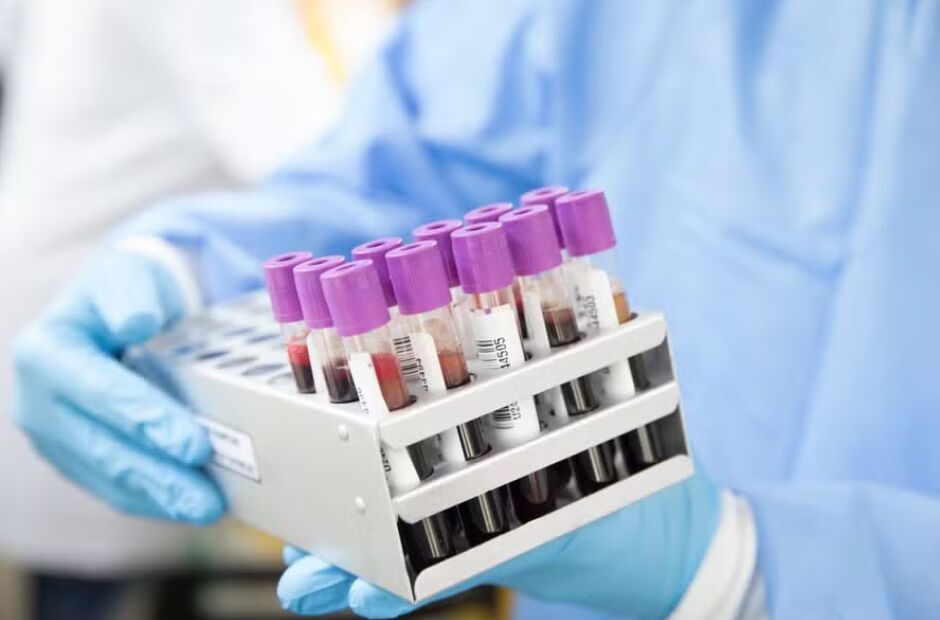 OMS define vírus da hepatite D como cancerígeno (ganhando a mesma classificação do HPV)