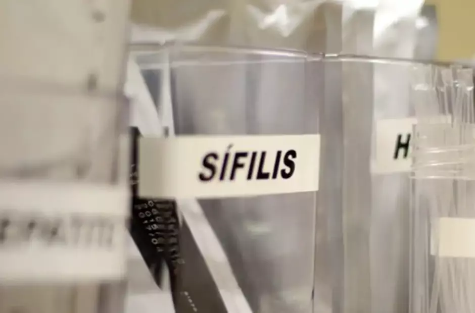 Sífilis continua em ritmo acelerado de crescimento no país