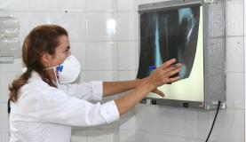 Médica examina radiografia de pulmão de paciente com tuberculose