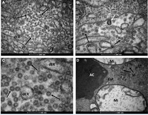 Microscopia Eletrônica do Culex