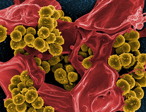 Bactérias podem desencadear serie de doenças quando conseguem colonizar o intestino 