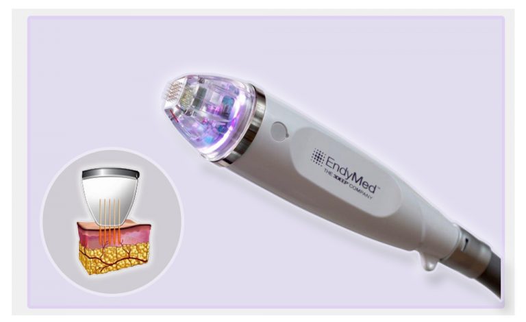 O microagulhamento de ouro é a nova revoluação em tratamento da pele para tratar rugas e melasmas