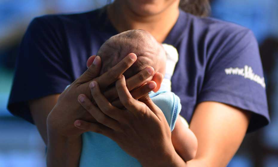 Bebê com microcefalia