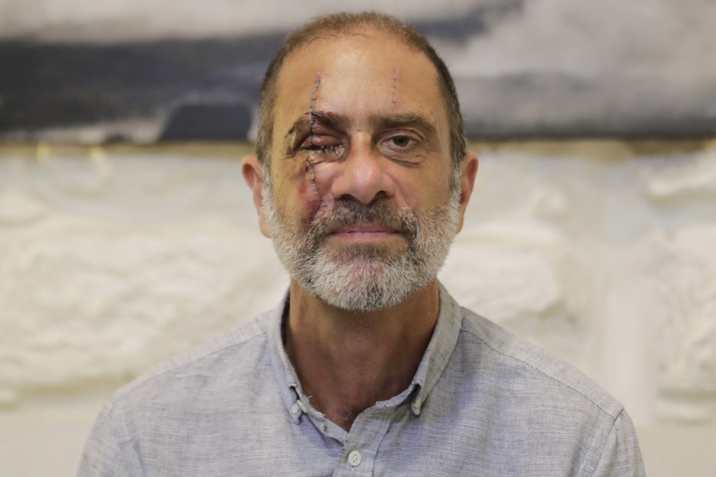 Rony Mecattaf, 59, perdeu a visão do olho direito na explosão em Beirute