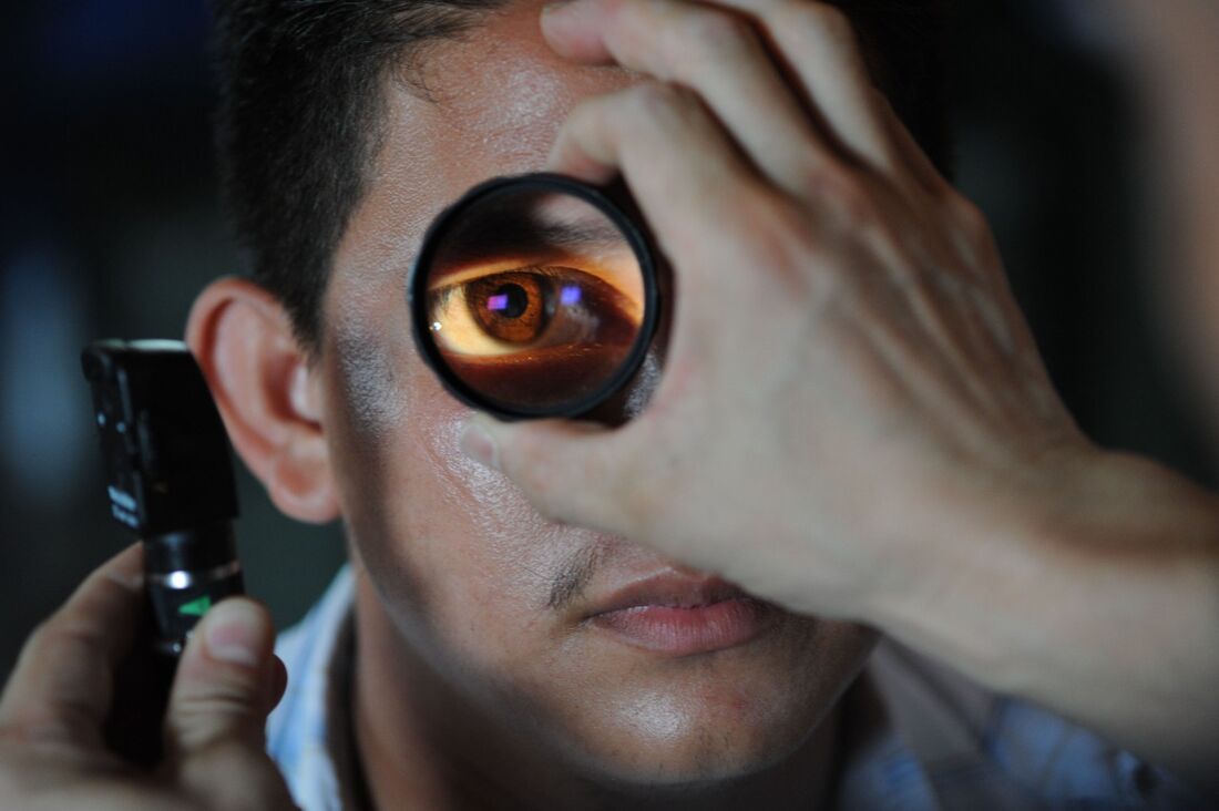 Glaucoma pode ser tratado com colírios, lasers ou até cirurgia