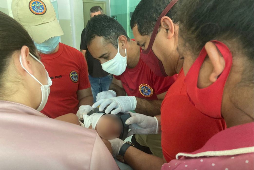 Um equipe do Corpo de Bombeiros conseguiu retirar o objeto