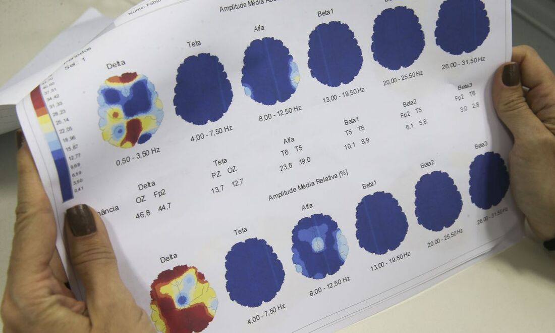 Epilepsia deve ser monitorada com auxílio médico