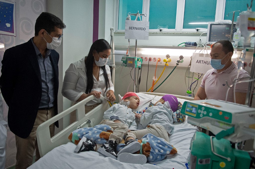 Gêmeos unidos pelo crânio foram separados em um hospital do Rio de Janeiro