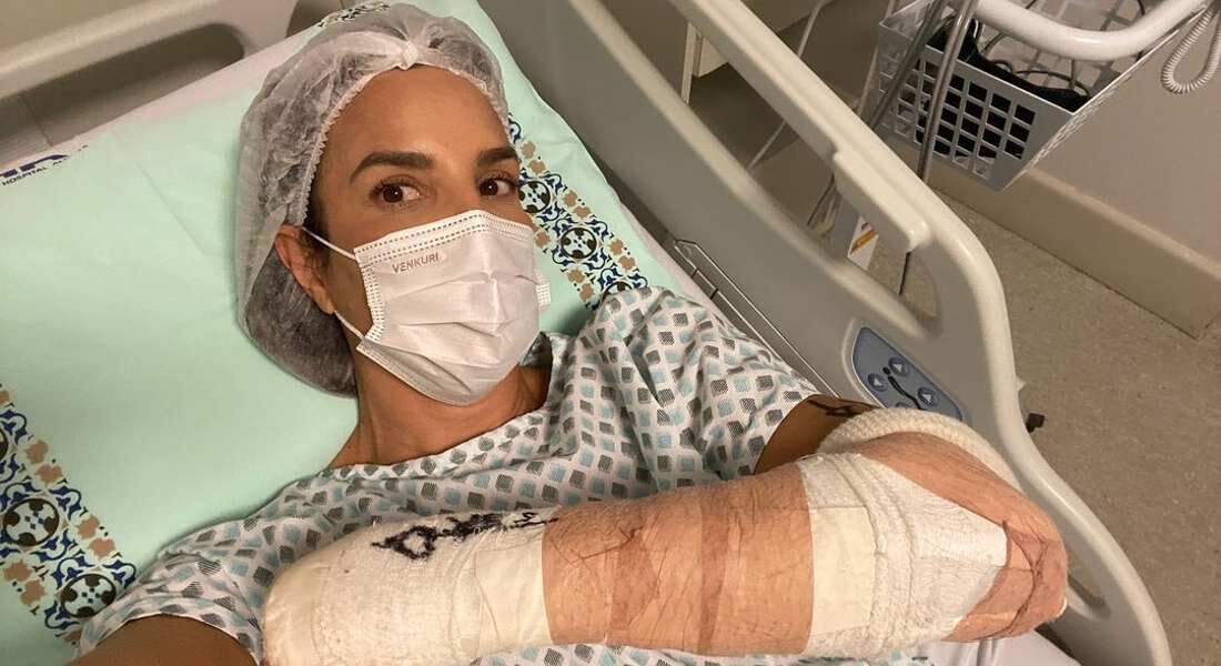 Ivete Sangalo passou por cirurgia no braço