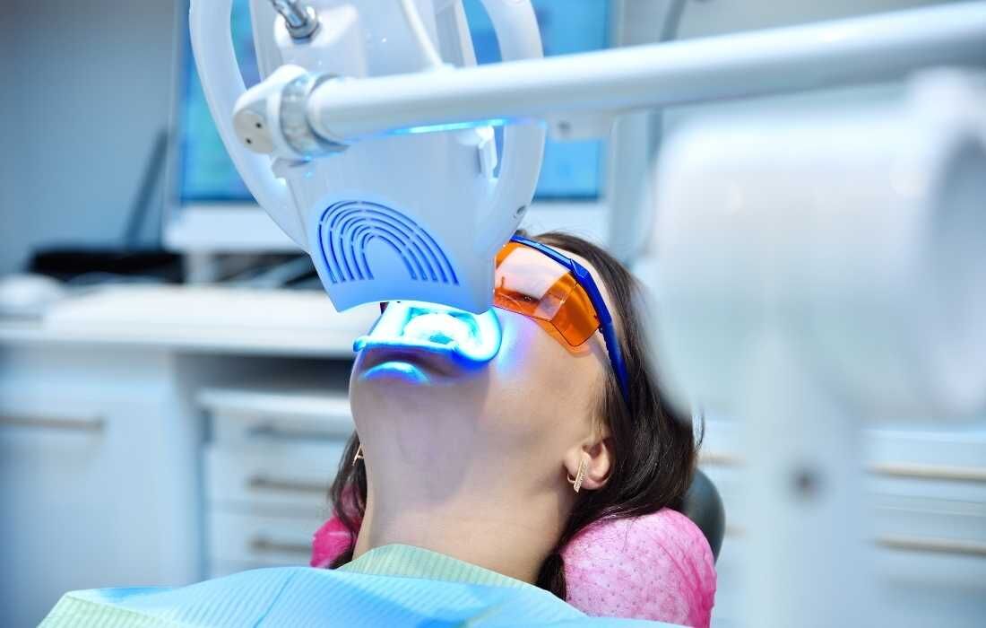 Riscos e cuidados necessários para colocar lente nos dentes