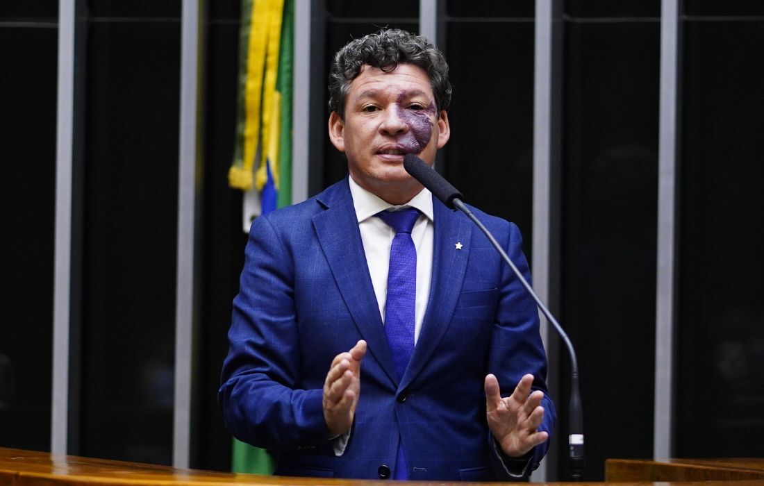 Deputado Reginaldo Lopes (PT-MG) 