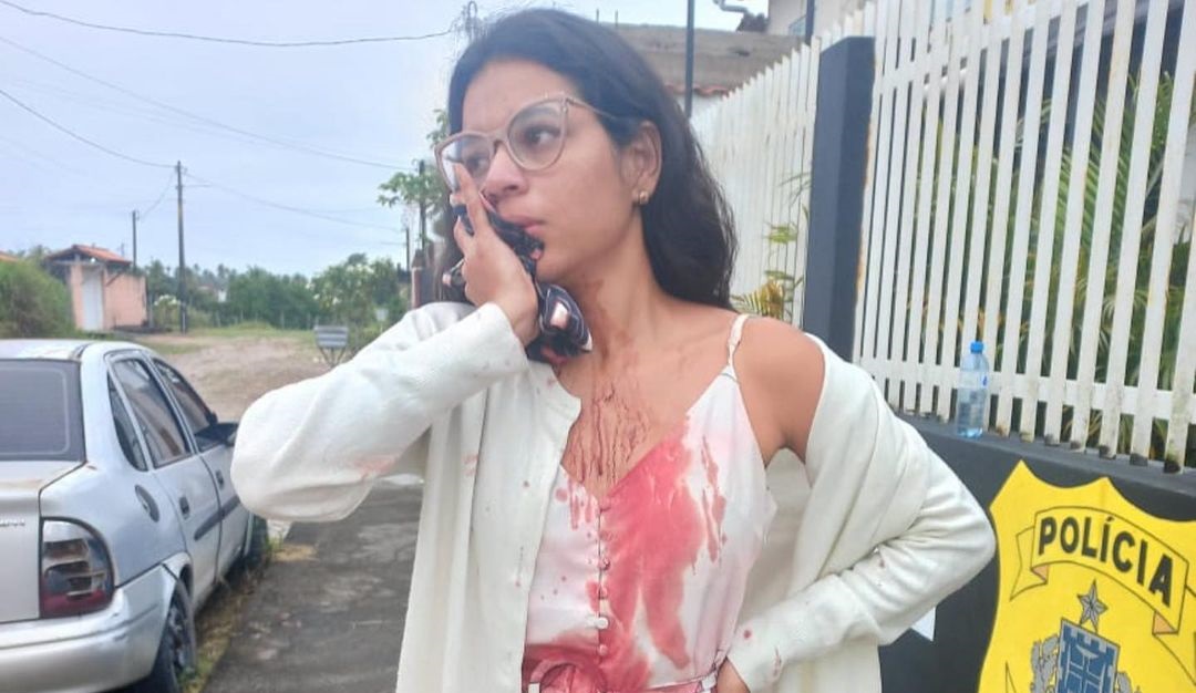 Mulher Tem Rosto Esfaqueado Enquanto Dormia Durante Viagem De Nibus Do Recife A Salvador Folha Pe