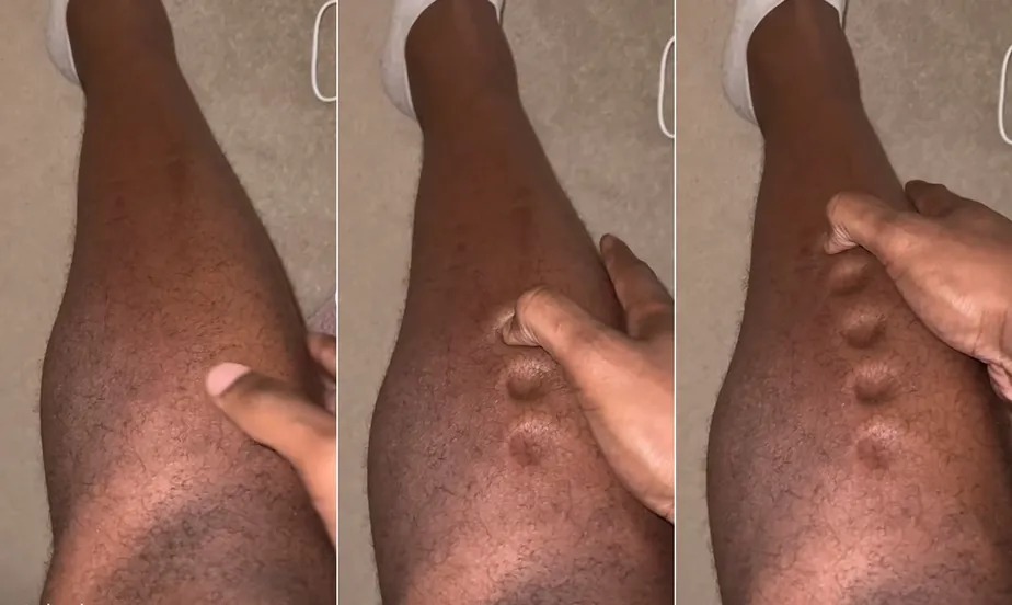 Perna de massinha do atleta