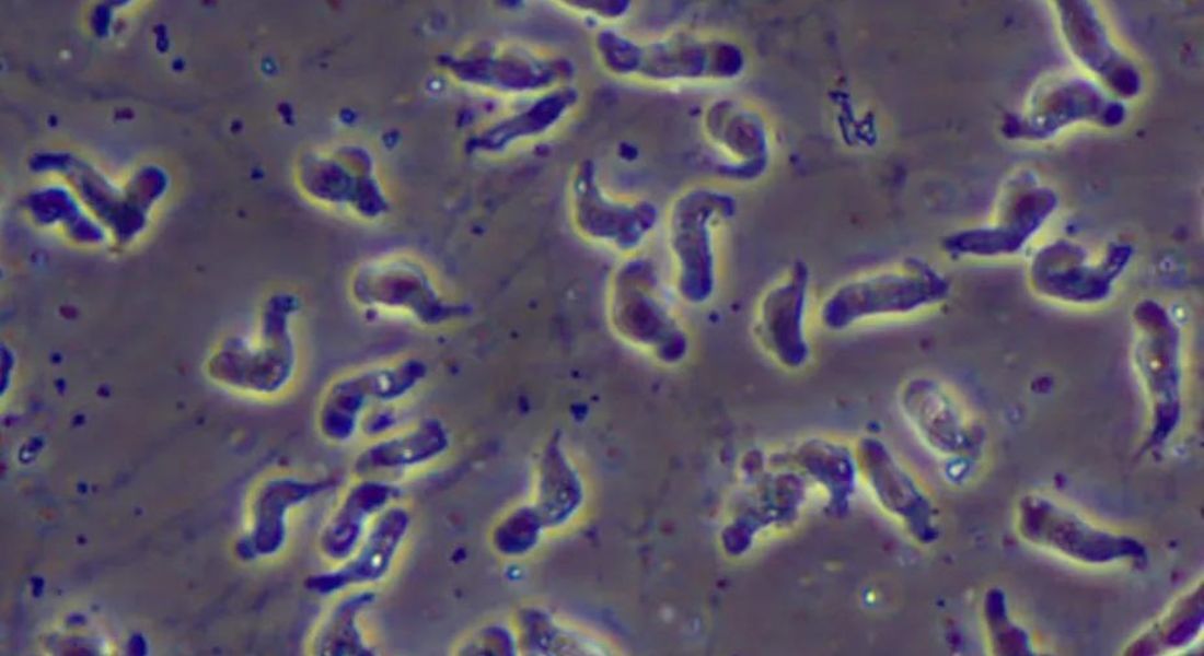 Ameba Naegleria fowleri, conhecida como "comedora de cérebros" 