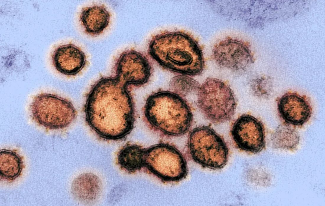 Imagem de microscópio eletrônico de transmissão mostra SARS-CoV-2, o vírus que causa o Covid-19, isolado de um paciente nos EUA