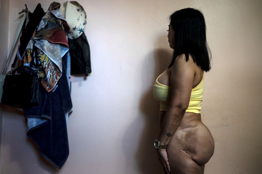 Técnica deixou marcas no corpo de María