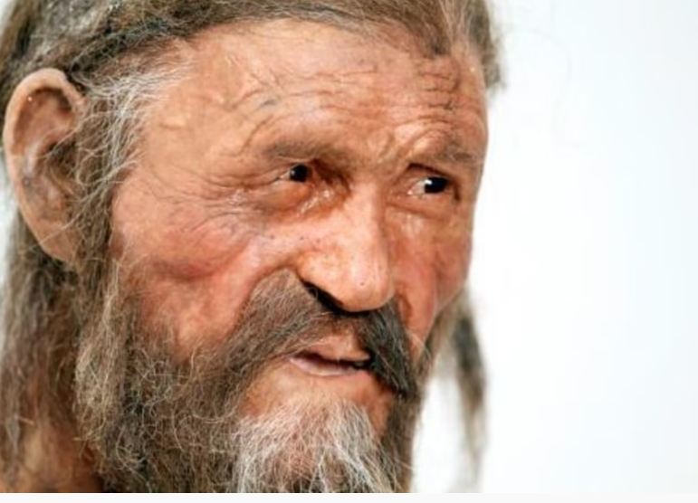 Ötzi: cientistas estimam ter cerca de 45 anos quando morreu, provavelmente tinha pouco cabelo e seus genes mostram uma predisposição à calvície.