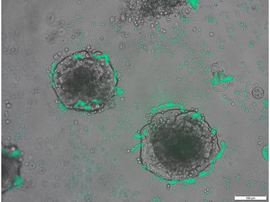 A bactéria Acinetobacter baylyi (verde) envolve aglomerados de células de câncer colorretal