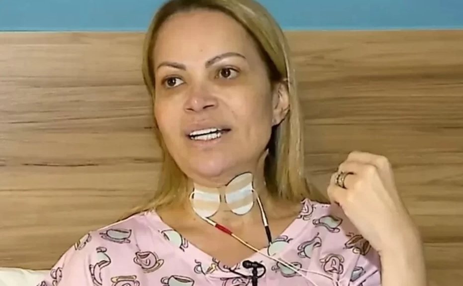 Solange Almeida falou dos tratamentos que fez por causa dos danos causados pelo uso de vape