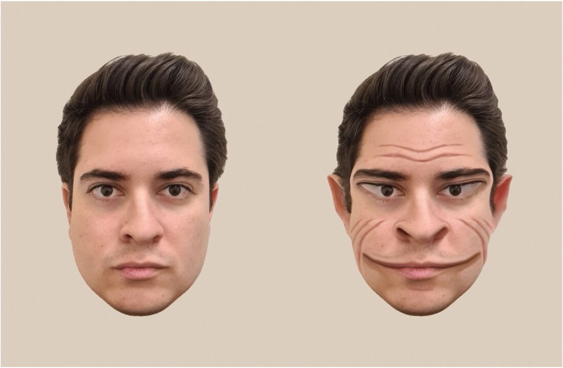 Imagem divulgada pelo Dartmouth College mostra uma visualização artística do pesquisador Antonio Mello ilustrando distorções faciais em um caso de prosopometamorfopsia 