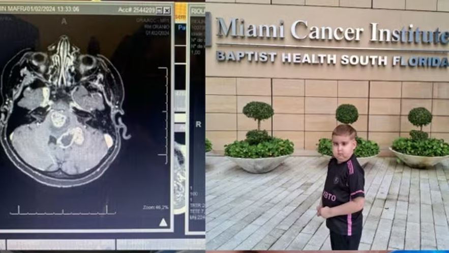 Benjamin Mafra Riolino, de 7 anos, foi diagnosticado com glioma difuso de ponte 