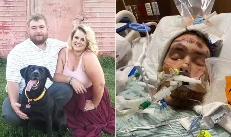 Sepse é uma reação extrema do sistema imunológico do corpo a uma infecção