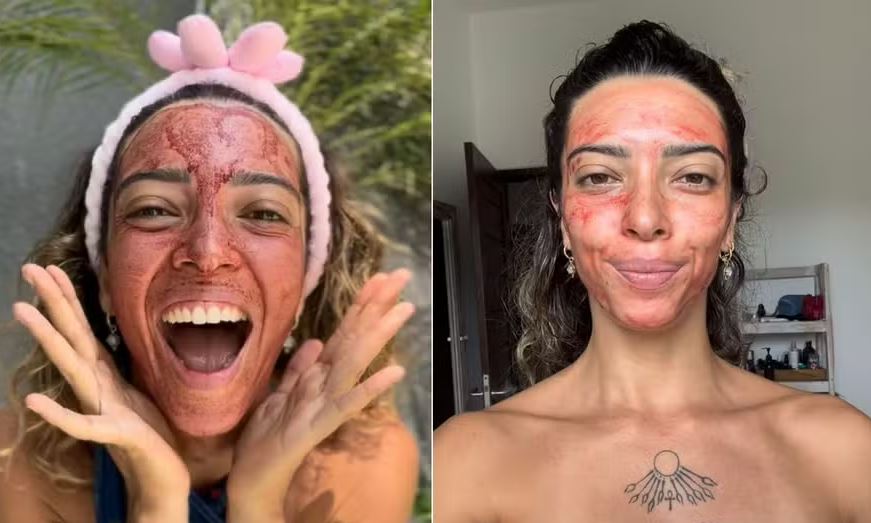 Sarah Sol, de 32 anos, utiliza sangue menstrual como máscara facial 