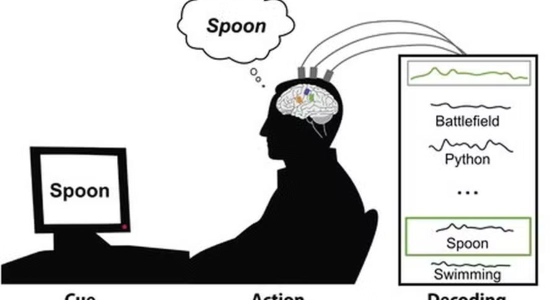 Implante cerebral transforma pensamento em fala