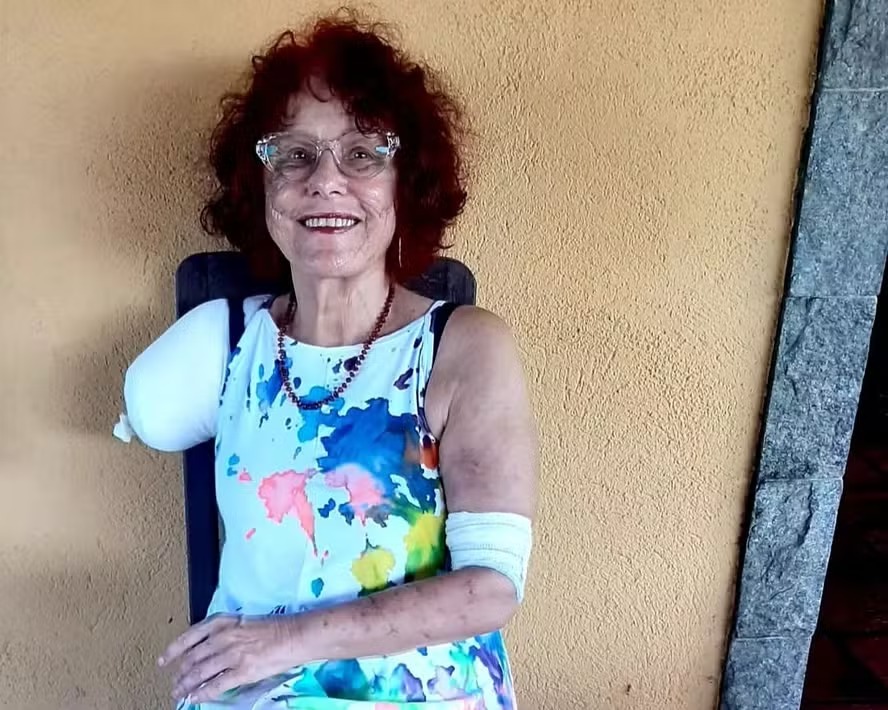 Autora de livros infantis, Roseana Murray que foi atacada por pitbull 