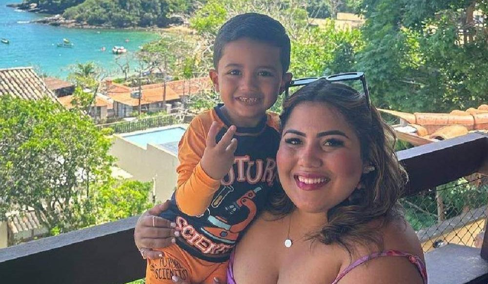 Davi Freire Zerbone, de 4 anos, teve queimaduras em 100% do rosto