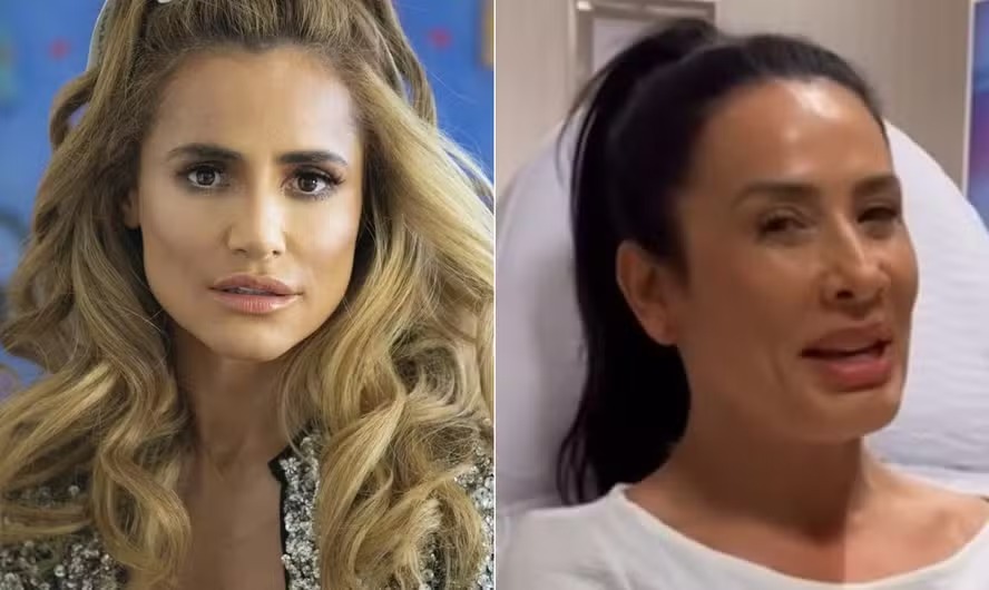 Wanessa Moura e Scheila Carvalho foram alguns dos famosos que fizeram desarmonização facial 