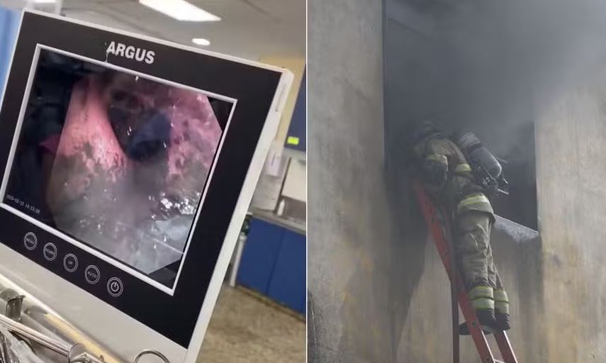 Exame mostra a quantidade de fuligem no pulmão das vítimas do incêndio em fábrica de fantasias no Rio 