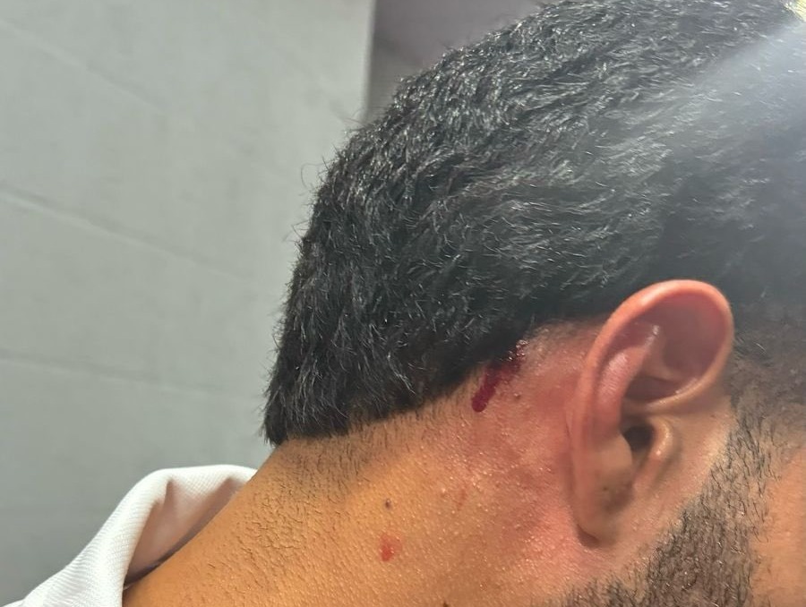 Massagista do Náutico foi atingido por uma pedra após o Clássico na Ilha do Retiro